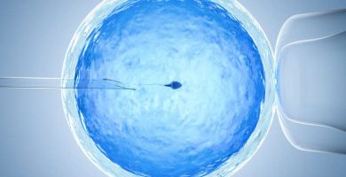 Fecundación in vitro fiv - icsi